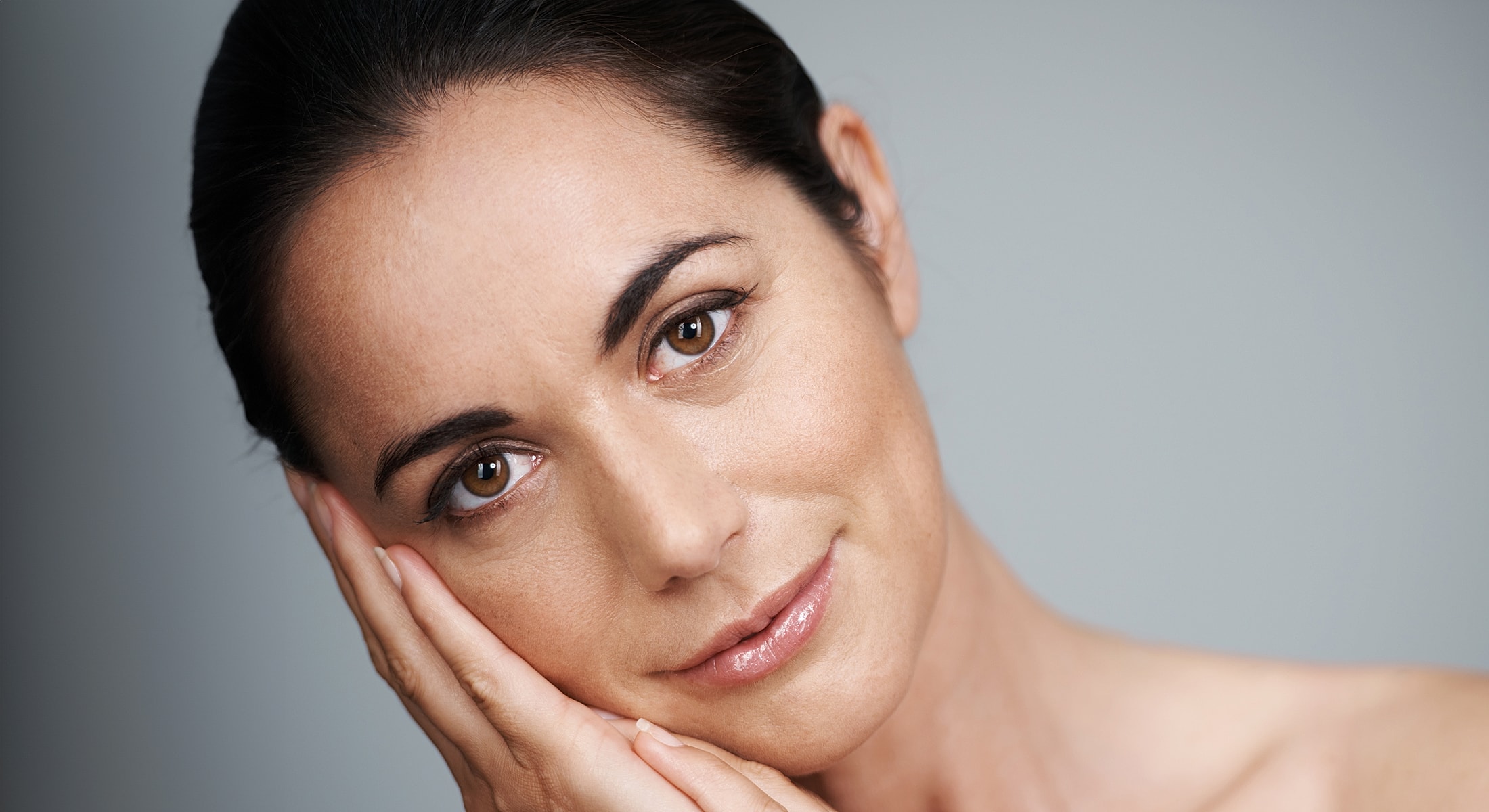 Lafayette blepharoplasty model resting her face with a gentle smile.